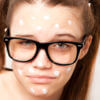 acne-zit-glasses-girl