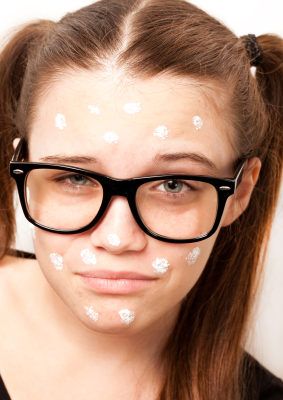 acne-zit-glasses-girl