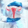 Understanding Endometrial Cancer Treatment and Diagnosis