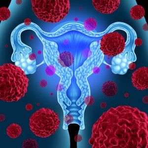 endometrial cancer risks symptoms and treatment